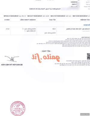 Tỷ Tỷ Cực – ảnh
